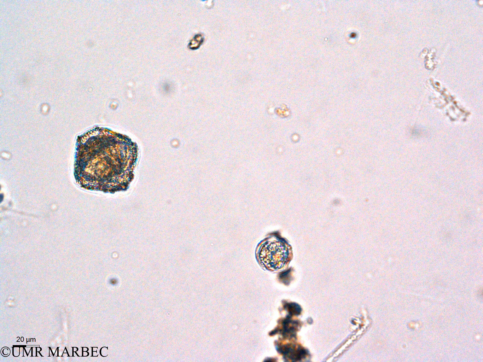 phyto/Thau_Lagoon/THAU_station1/GELAMED 2010/Lingulodinium polyedrum (ancien Protoceratium reticulatum syn. Gonyaulax grindleyi -2)(copy).jpg